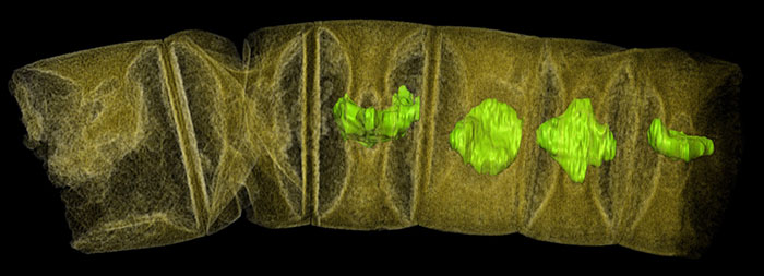 X-ray image of a fossil thread-like red algae