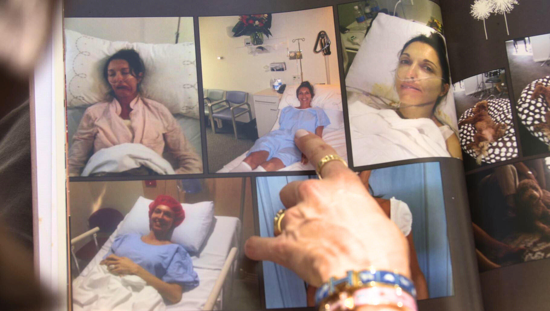 A hand points at a scrapbook of photos showing a woman in hospital in a collage of pictures 