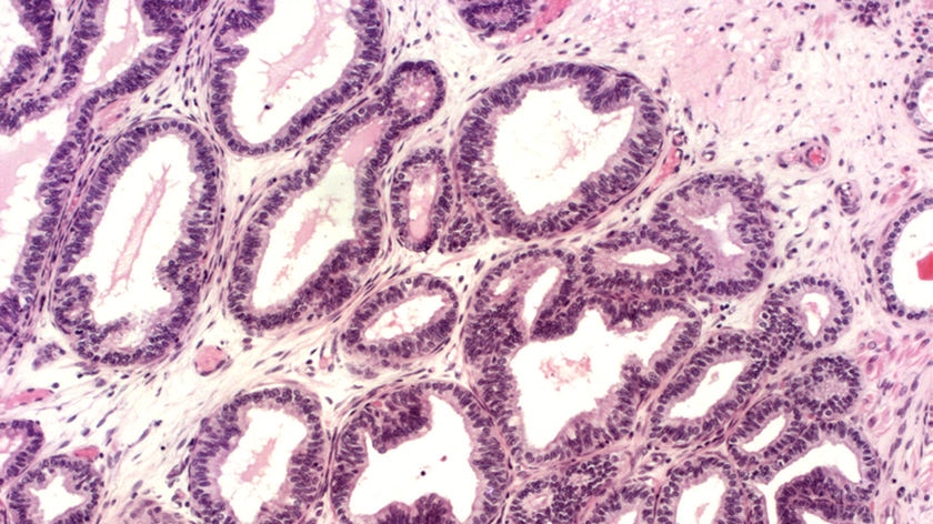Photo of prostate cells