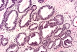 Prostate cells
