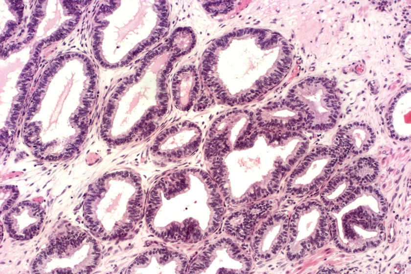 Photo of prostate cells