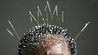 Acupuncture (China Photos, Getty Images)