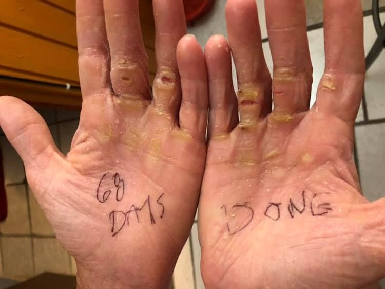 Влияние на организм употребления алкогольных напитков и курения презентация он