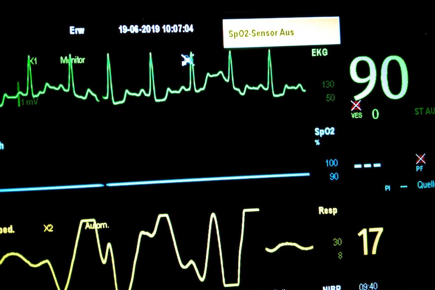 An ECG showing high blood pressure, high heart rate and irregular breathing.