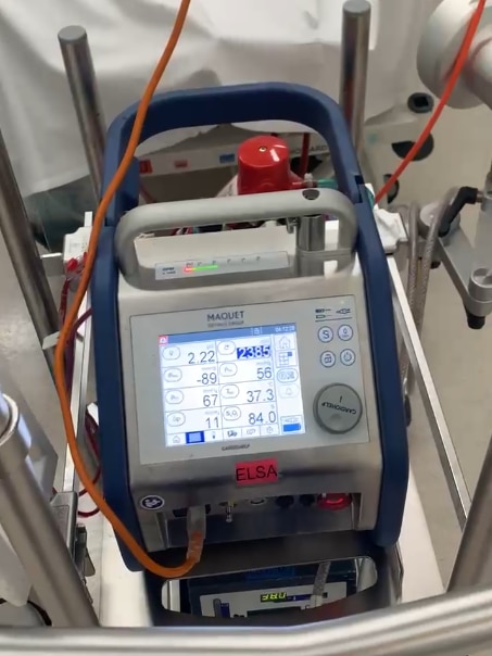 A hospital machine called ECMO.