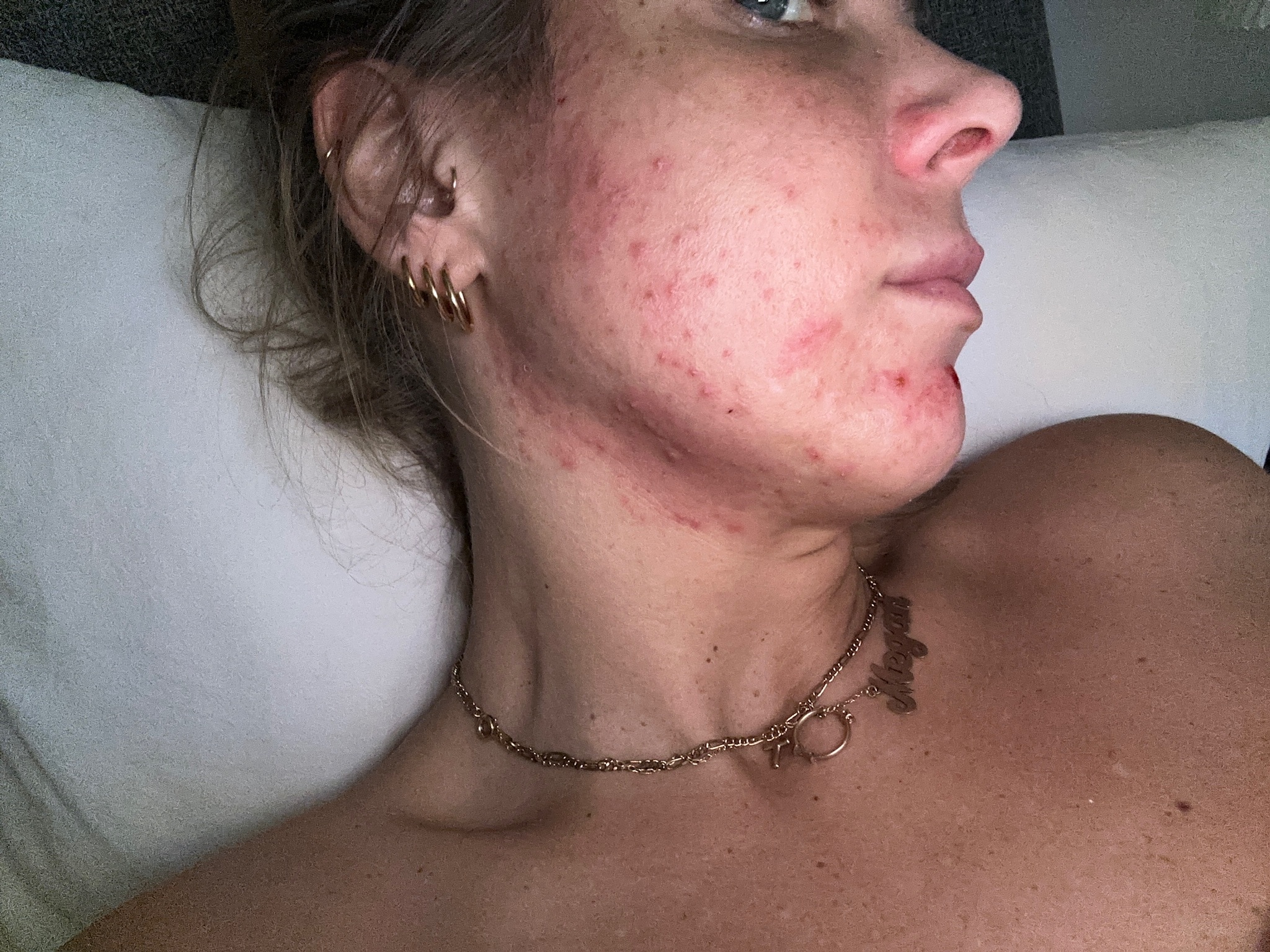 Megan Hancocks skin