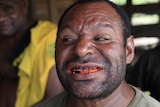 A PNG man shows his red stained teeth.