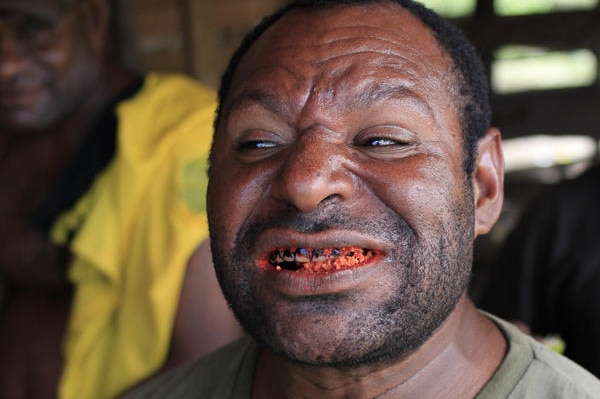 A PNG man shows his red stained teeth.