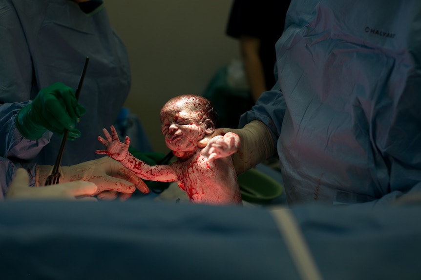 Doctors hold new born baby up to the light while it is still covered in fluids from the birth