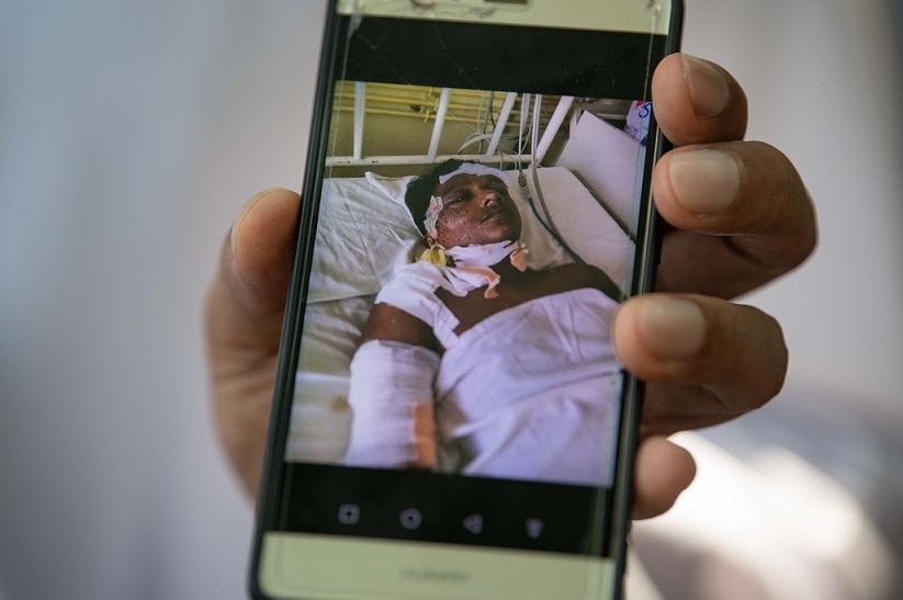 An iPhone photo of one of the victims of the Sri Lanka bombings, a young boy who has lost his hearing.