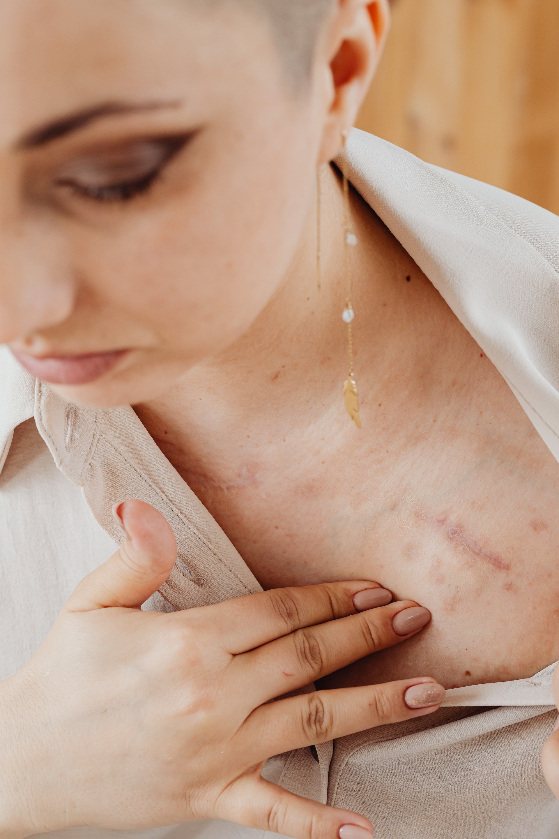 A woman holds her fingers to her collarbone where a long scar can be seen
