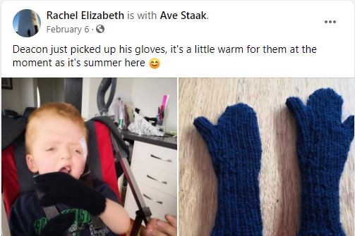 Deacon Staak's mittens were custom made to fit his unusually shaped hands