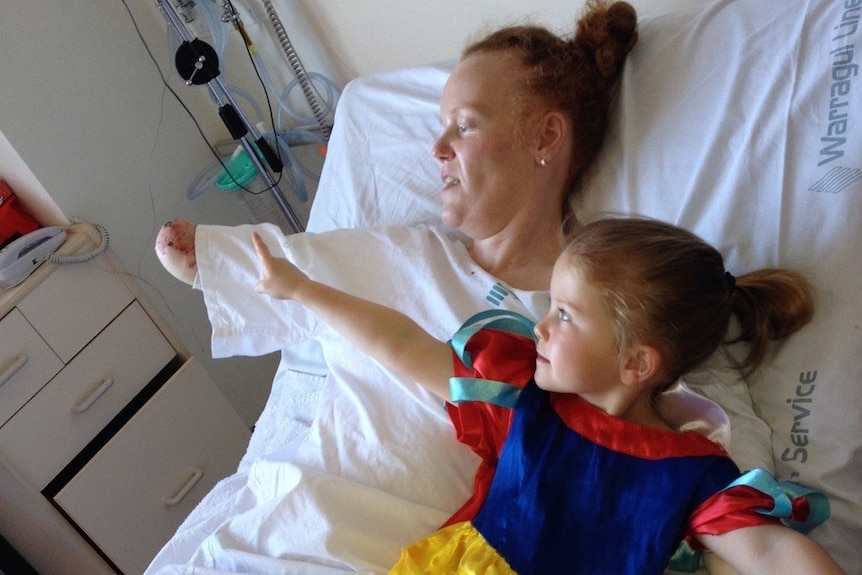 A woman lies in a hospital bed holding up her amputated arm. A young girl lies beside her pointing.