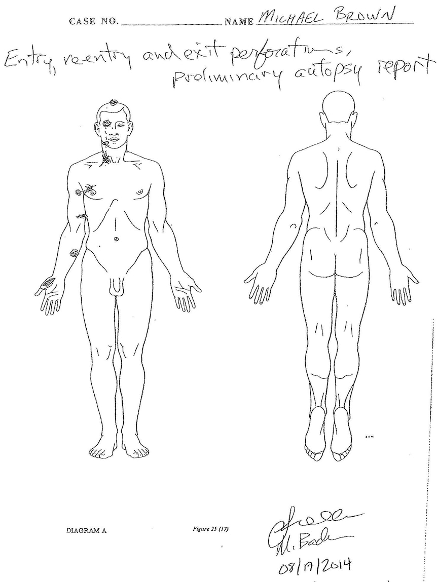 Michael Brown preliminary autopsy diagram