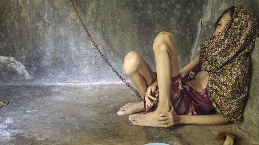 A women with shackled on one of her feet