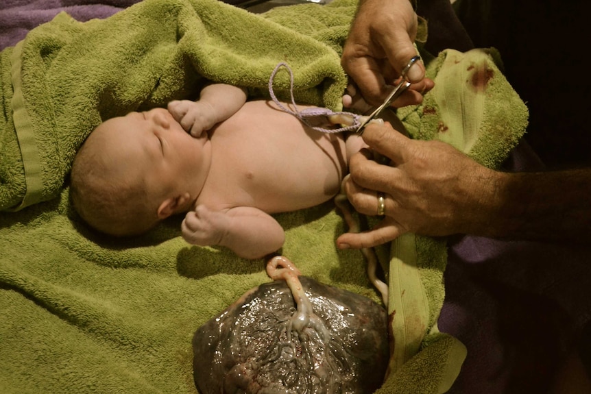 Baby's placenta being cut after free birth