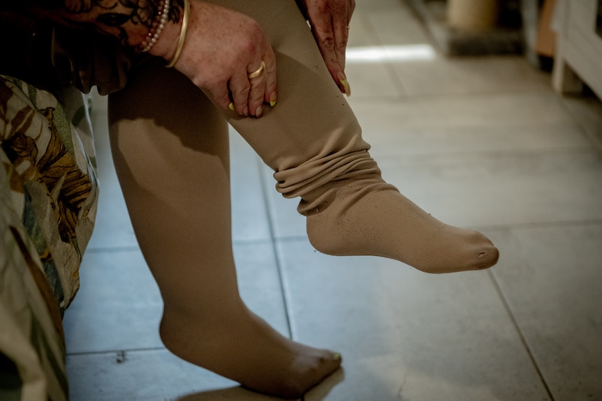 A close-up of Dee's feet and calves as she pulls on tight, flesh-coloured compression stockings.
