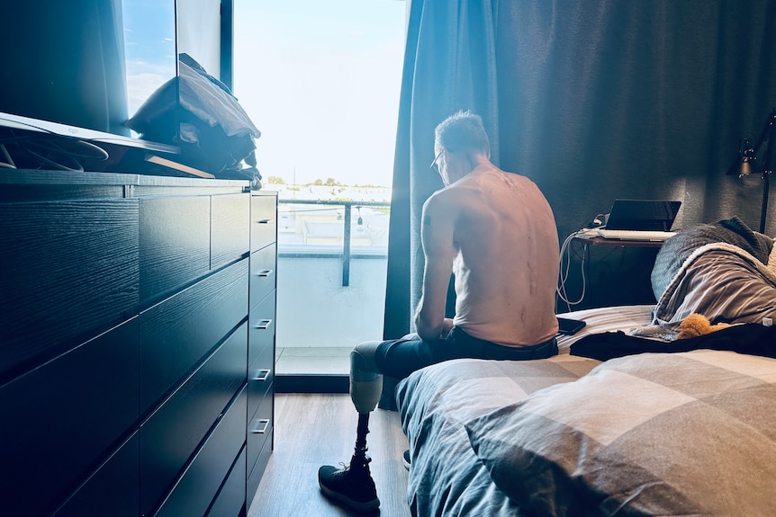 A man sits on the edge of a bed looking outside. His back is scarred and his prosthetic leg is visible.
