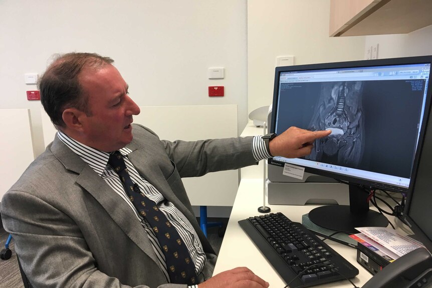 Professor Chris Kimber points at an X-Ray of a girl's pelvis on his computer monitor.