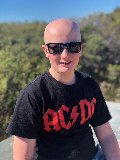 A young boy with alopecia wearing sunglasses.