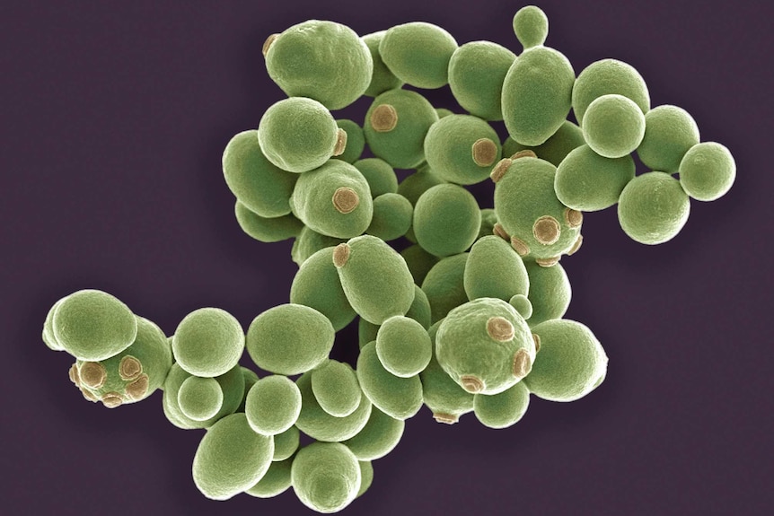 Brewer's yeast as seen under a scanning electron microscope.