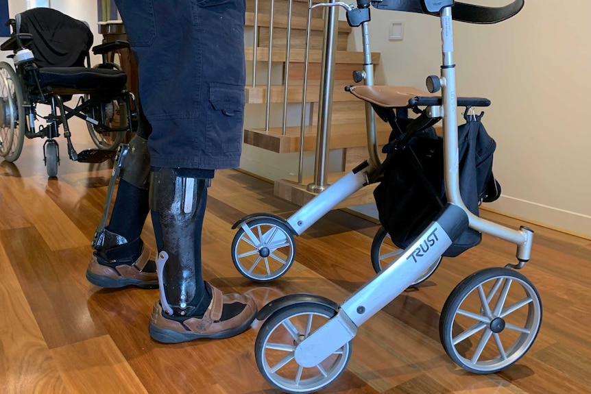 A photo showing Peter Willcocks's legs with braces below the knee walking with the assistance of a walker.