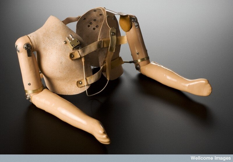 Exploring human enhancement at the Superhuman Exhibition - ABC listen