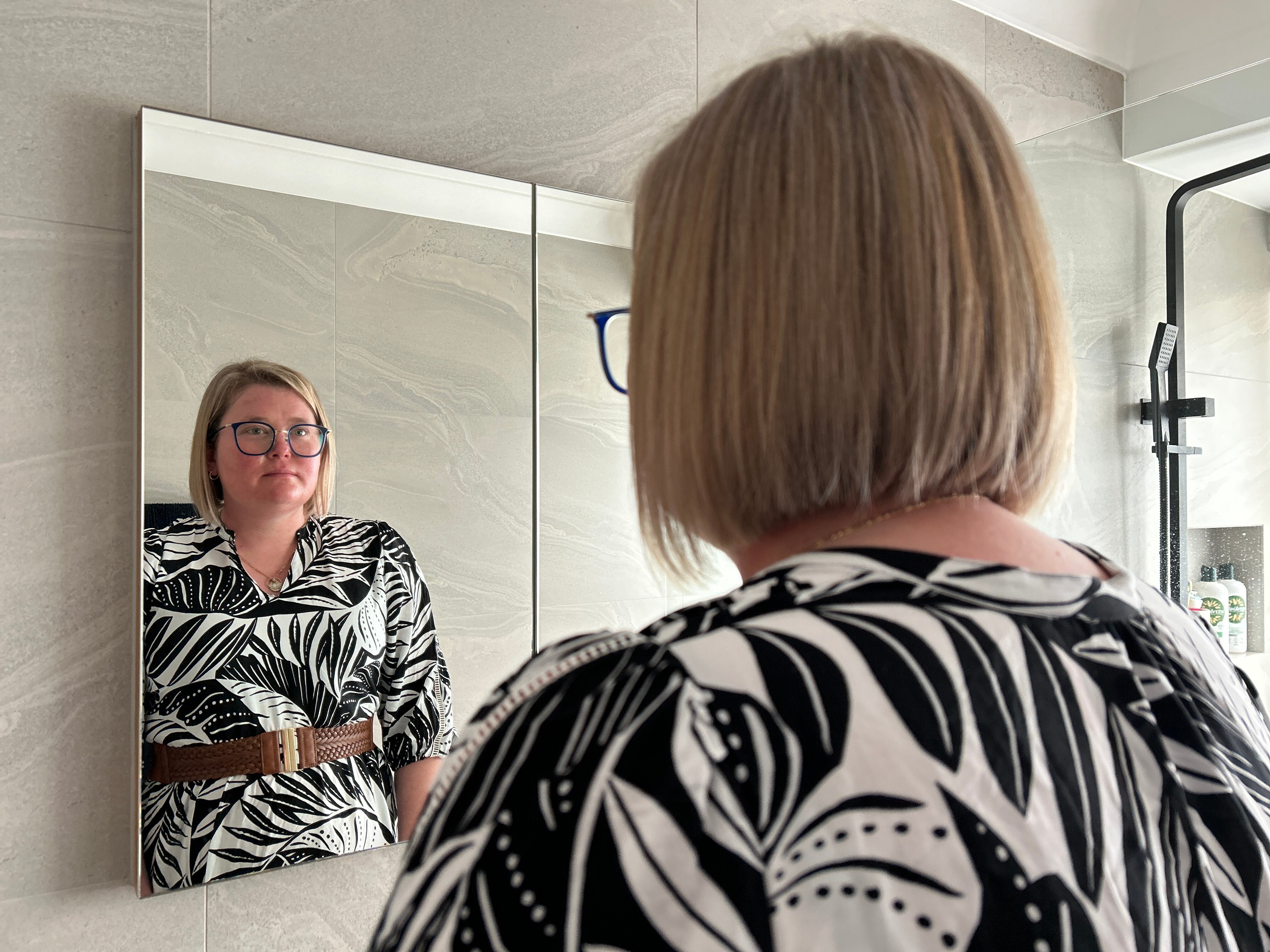 A woman with eczema and glasses looks at herself in the mirror.