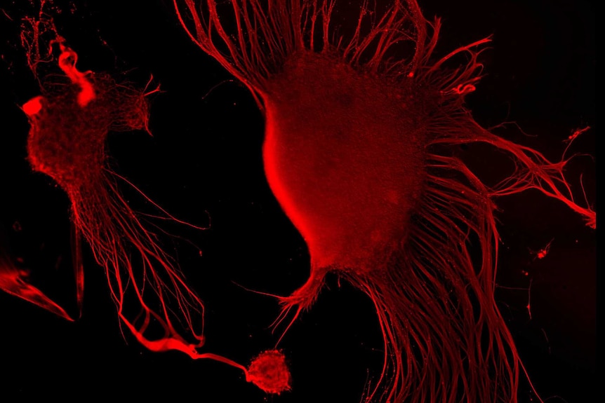 Image of neural stem cells for an artwork