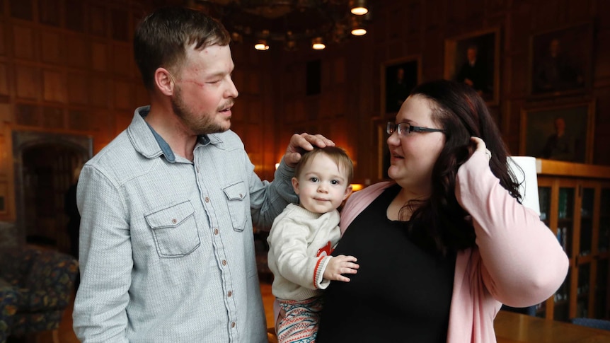 Lilly Ross, right, holds her 17-month-old son Leonard as she talks with face transplant recipient Andy Sandness.