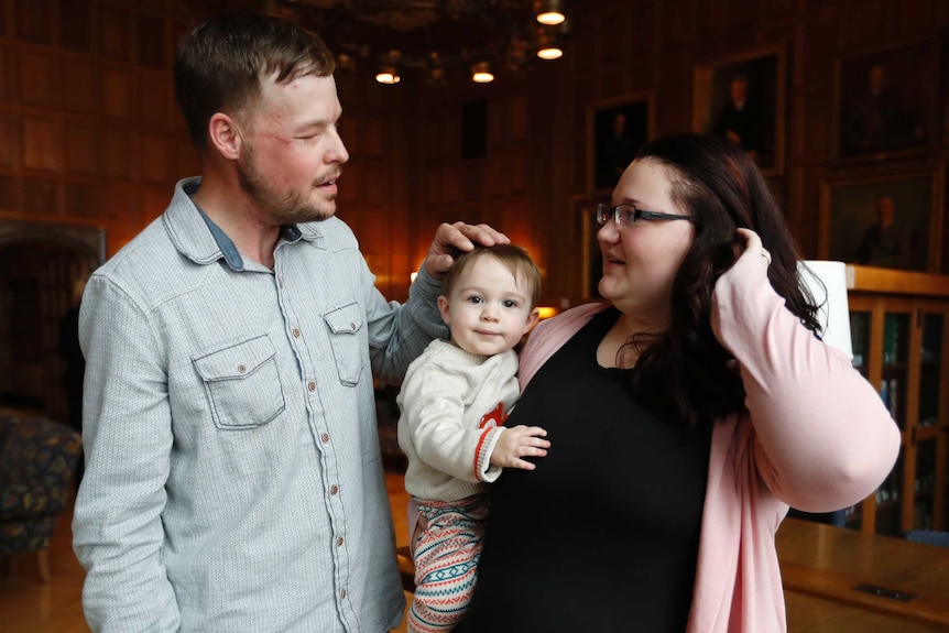Lilly Ross, right, holds her 17-month-old son Leonard as she talks with face transplant recipient Andy Sandness.