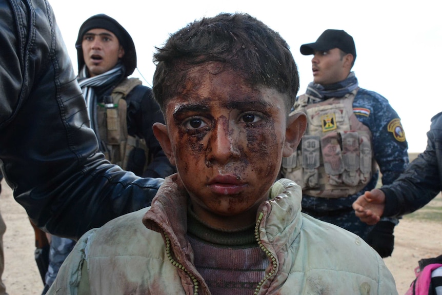 An injured Iraqi boy flees with his family from Hawijah
