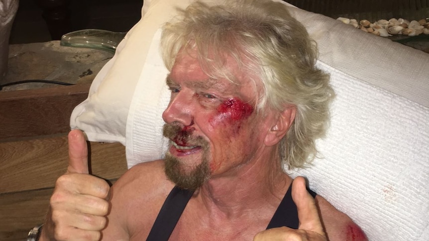 Richard Branson after bike accident