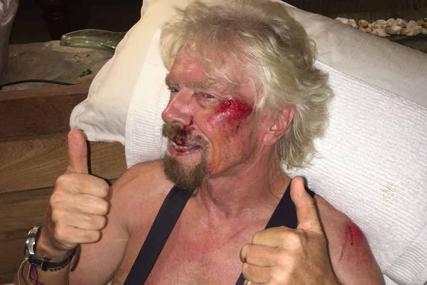 Richard Branson after bike accident