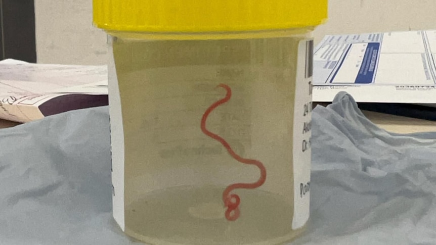 A worm in a specimen pot