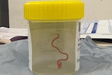 A worm in a specimen pot