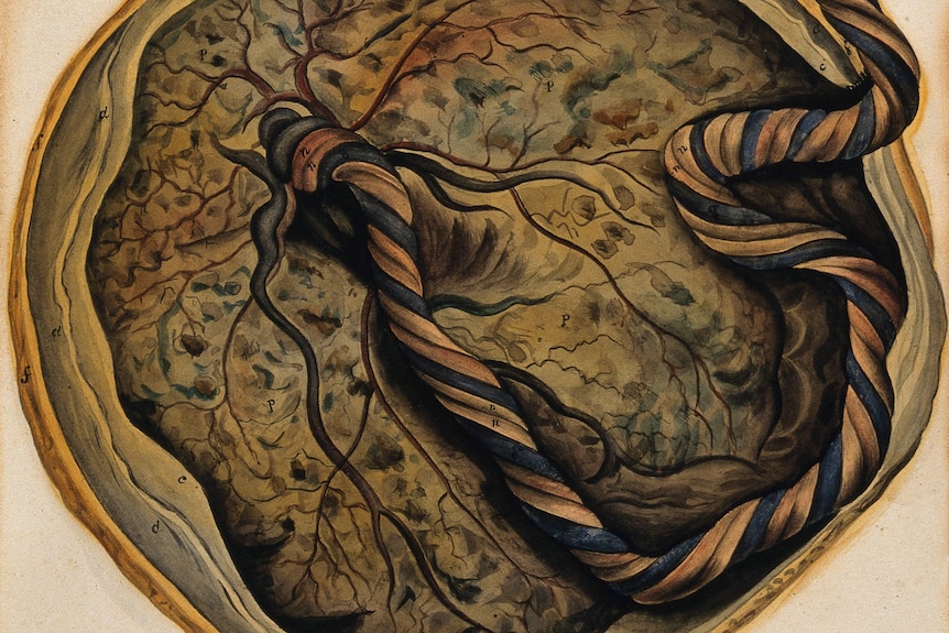 A watercolour image of the placenta and umbilical cord.