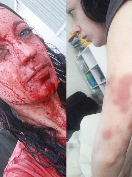 Two photos showing woman covered in animal blood and bruises on her arm.
