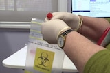 Hands holding a vial put it into a small bag with a biohazard symbol on it