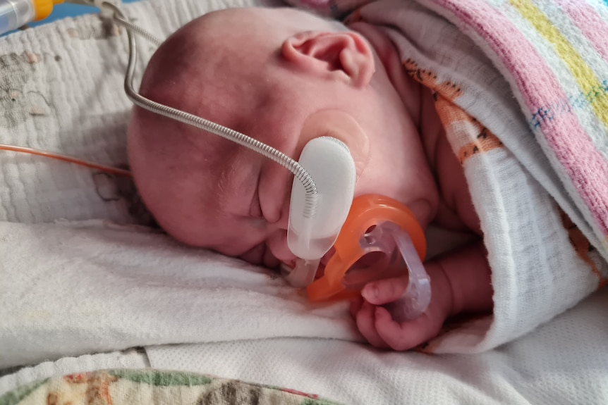 Premature baby Levi Atkinson in hospital in Brisbane in 2022