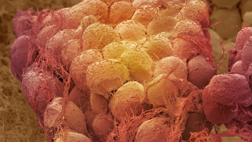 Pink and yellow blobs seen under a microscope