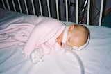 Baby Angus with special breathing mask to treat sleep apnoea