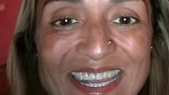 Forty-two-year-old mother of two Griselle smiling and showing her fixed tooth.
