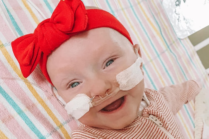 A baby with an oxygen tube in its nose wearing a red bow