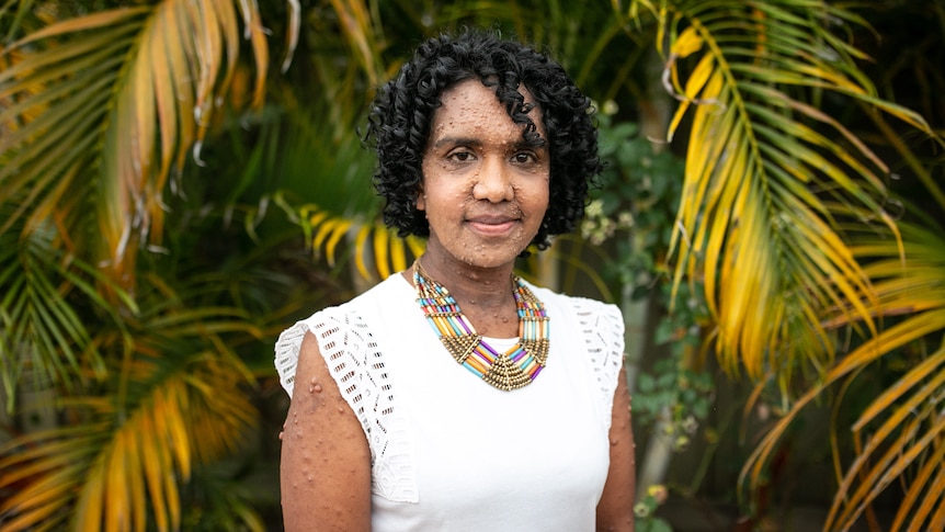 A woman stands in front of palm trees