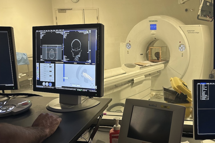 A head in a glass case being CT scanned, with a screen showing a scan of the head.