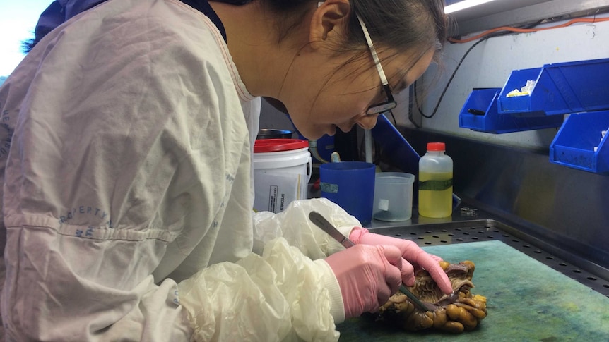 An anatomical pathology trainee looks at bowel tissue.