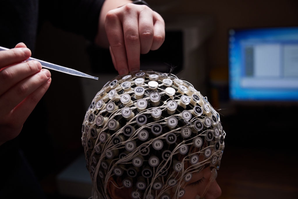 EEG turns 100 - how this tech has revolutionised our understanding of the brain