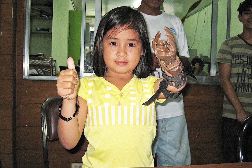 Geraldine, a schoolgirl in Bangalore, age unknown, gives the thumbs up while wearing a prosthetic hand.