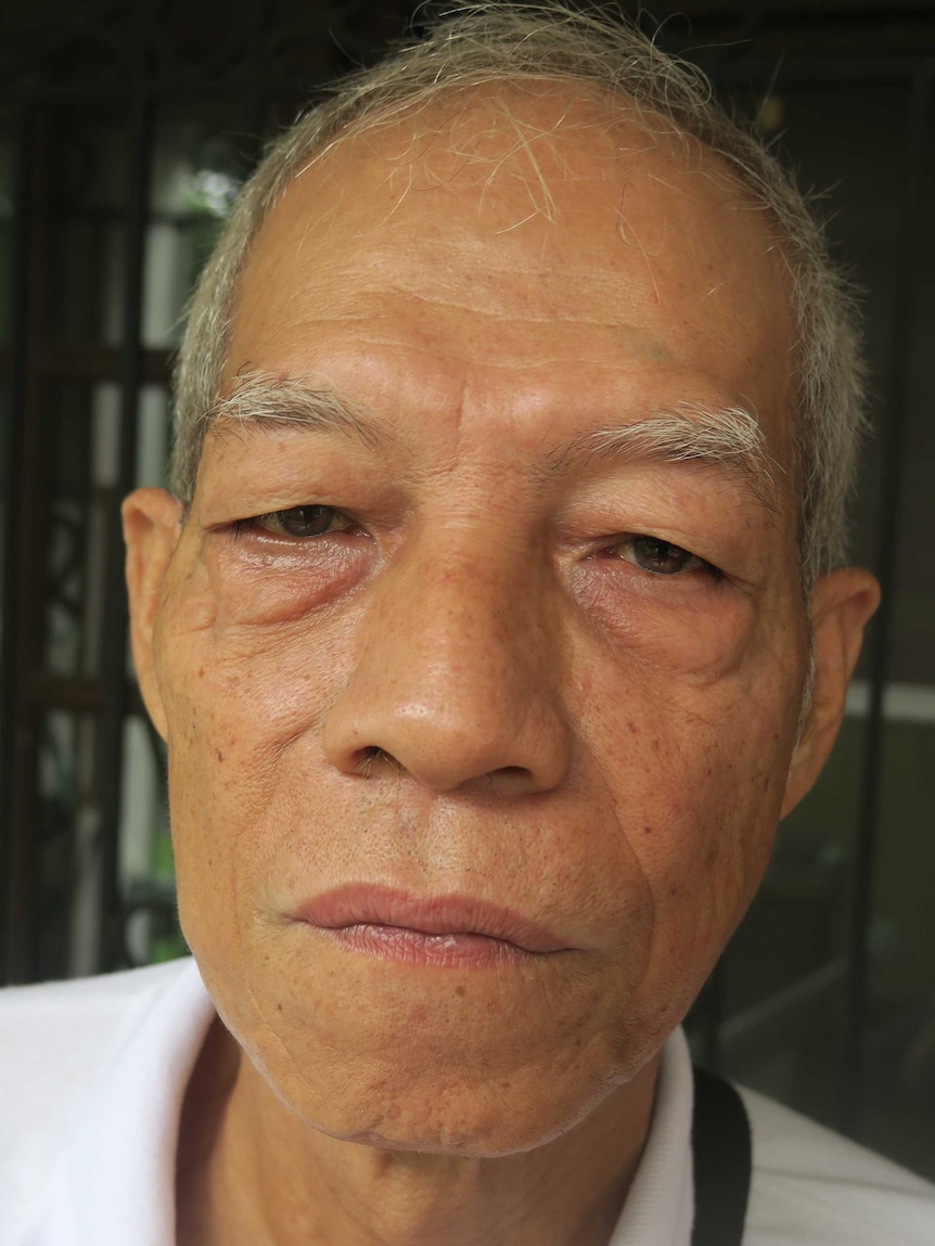 Torture victim Felix Dalisay has petitioned the Supreme Court to stop the reburial of former dictator Ferdinand Marcos.